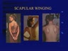 SCAPULAR EXERCISES